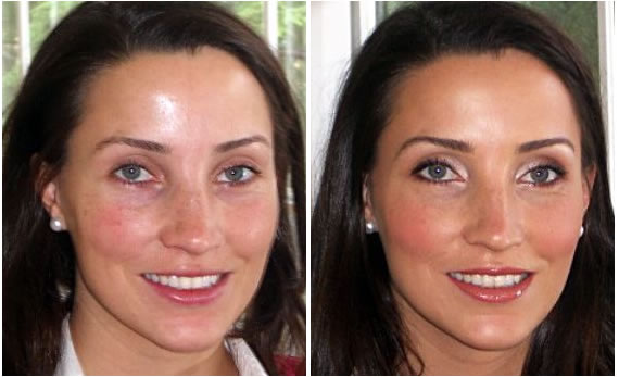 Eyebrow shaping clinic Vancouver